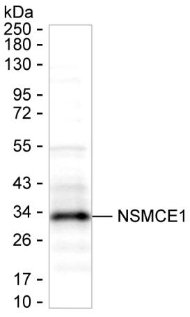 NSMCE1